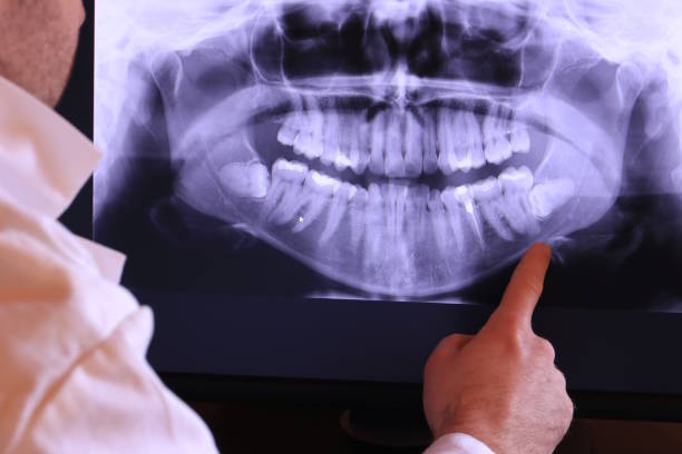 Best Emergency Broken Tooth Repair in Hamshire, TX