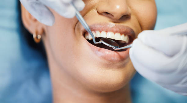 Best Emergency Wisdom Teeth Removal in Hamshire, TX
