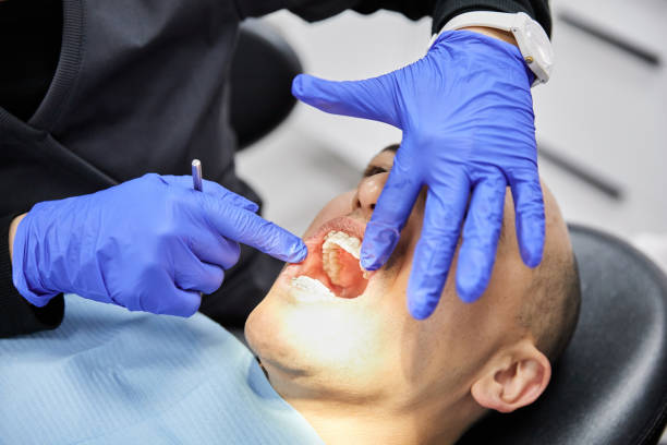 Best Emergency Dental Surgery in Hamshire, TX