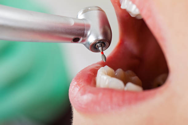 Best Emergency Treatment for Toothache in Hamshire, TX